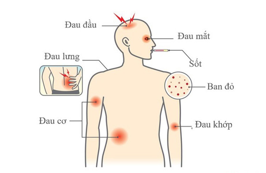 [ẢNH] Những loại bệnh dịch phổ biến do thời tiết ở Việt Nam